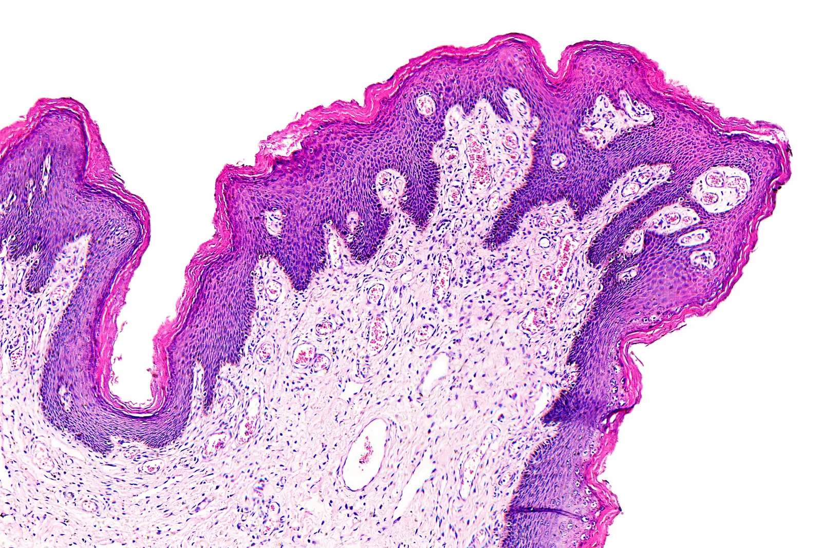 Pathology News Roundup: June 14, 2022