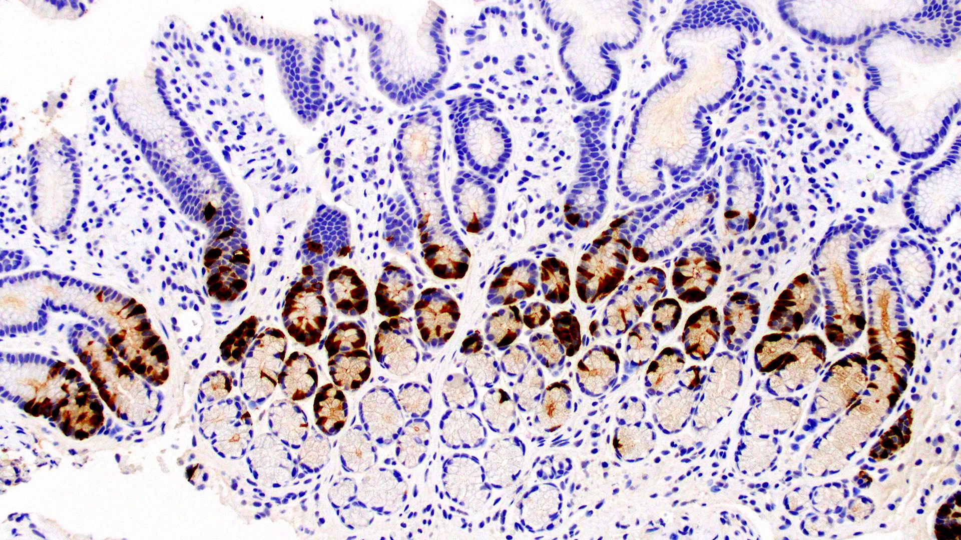 IHC Guideline