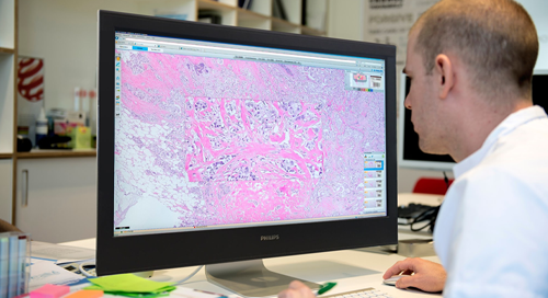 Image Courtesy of Royal Phillips/Philips IntelliSite Pathology Solution