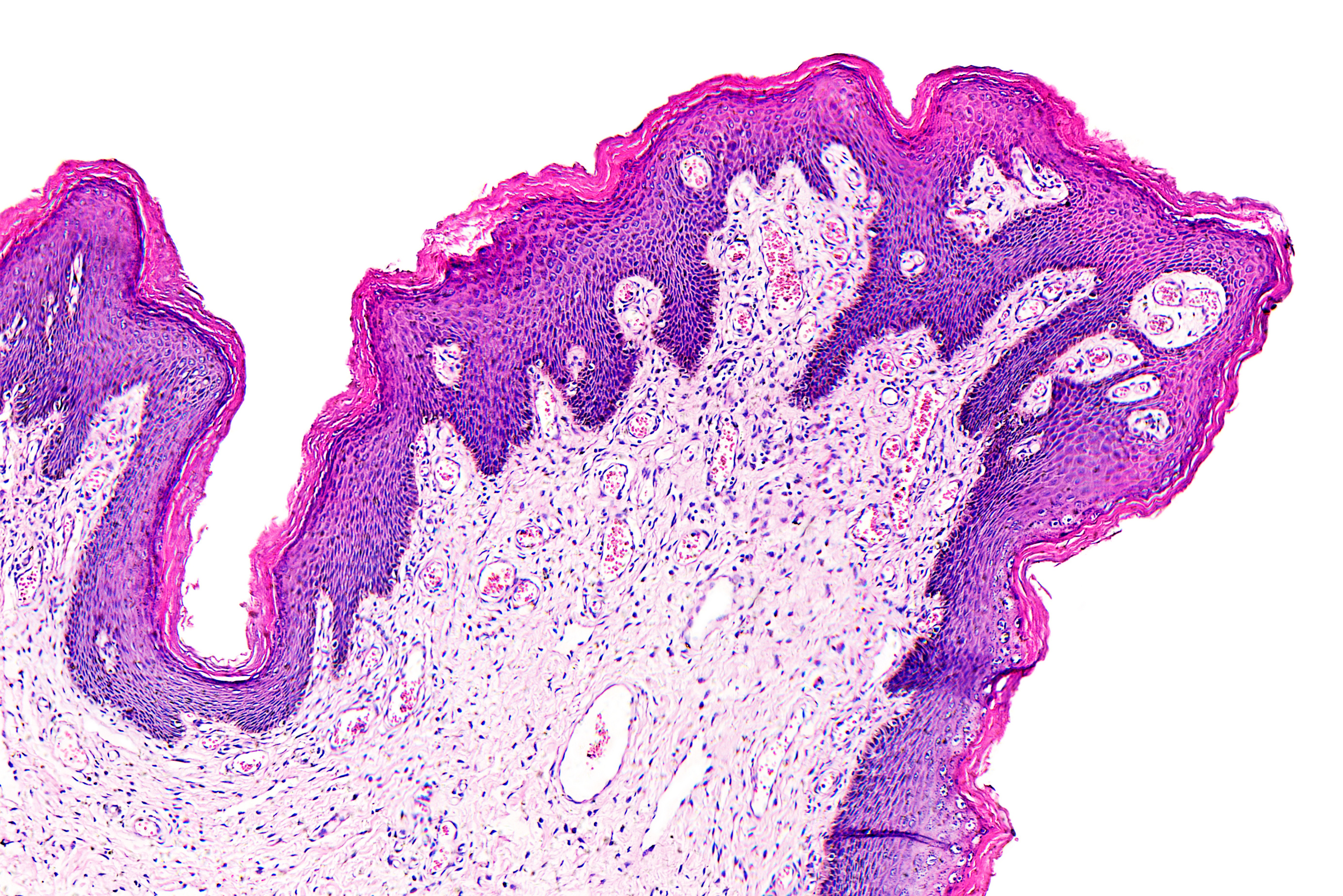 Pathology News Roundup: April 20, 2022