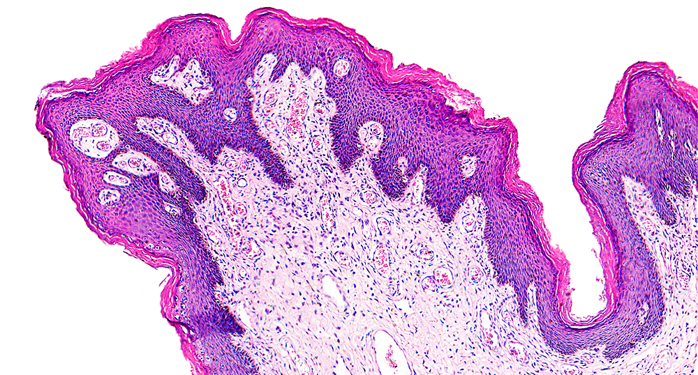 Pathology News Roundup: February 22, 2022