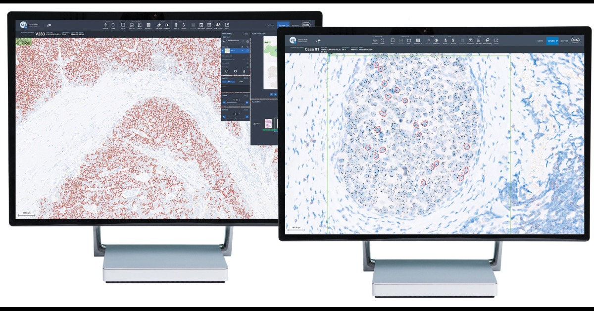 Pathology News Roundup: January 12, 2021